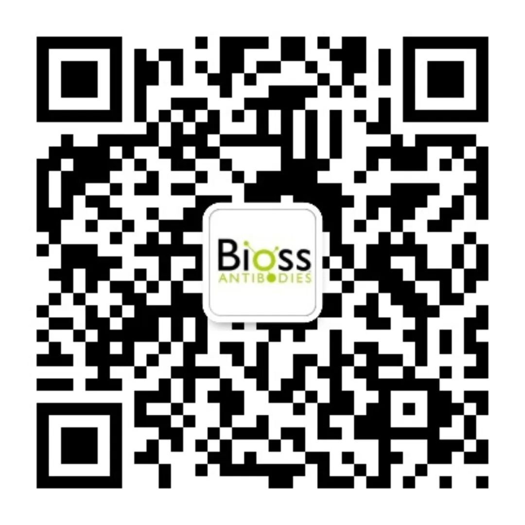 WB超级专题月 | 四 WB全套试剂选择指南