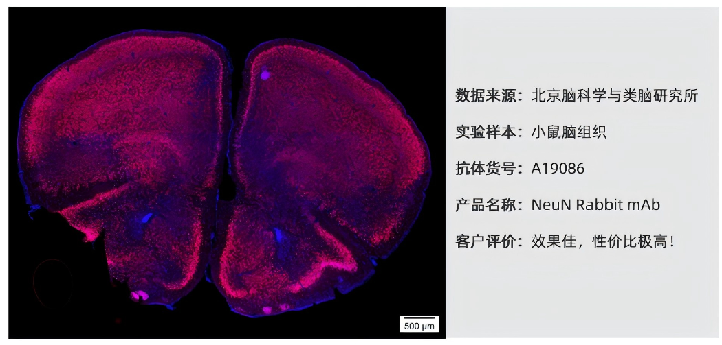一支抗体,如何让“实验重复不出来”的噩梦成为过去?
